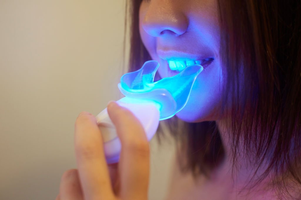 At-Home Teeth Whitening