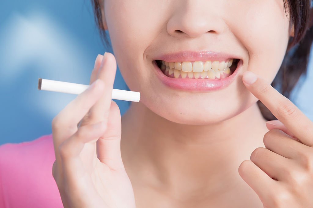 Relationship Between Smoking and Oral Health