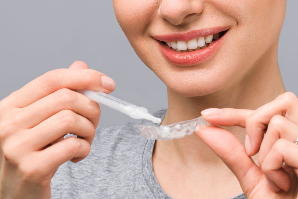 The Ultimate Guide to Teeth Whitening