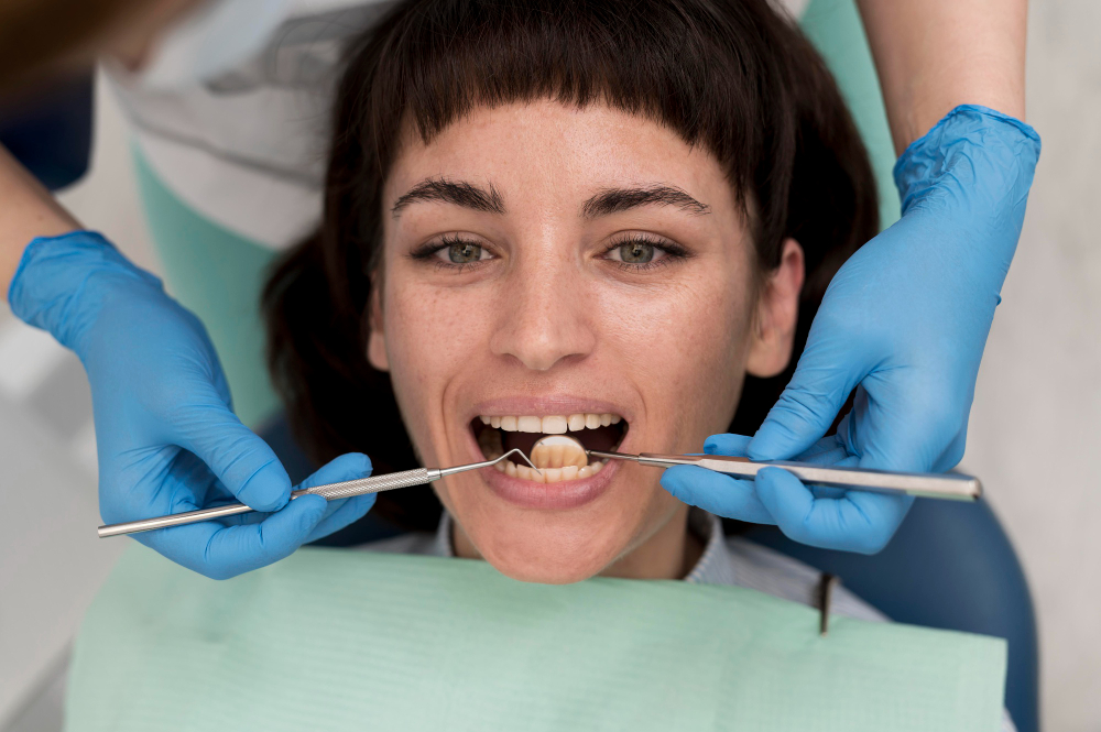 Filling between Front Teeth