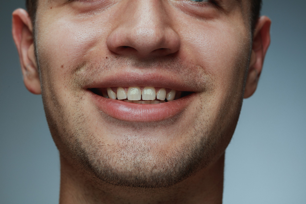 Filling Gaps Between Teeth and Gums