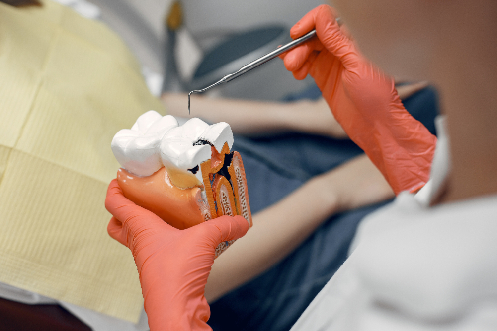 When to Replace a Cavity Dental Filling